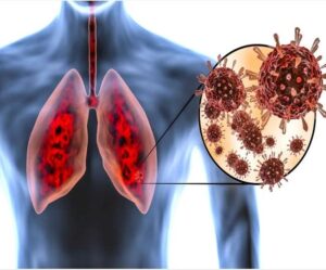 27_05_2021-lungs-damage_21681936